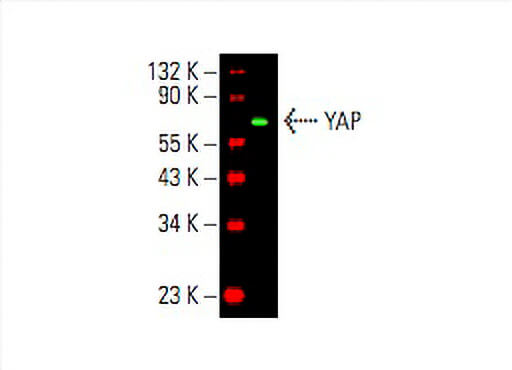 【あや様オーダーページ】 YAP Antibody (H-9) | SCBT - Santa Cruz Biotechnology