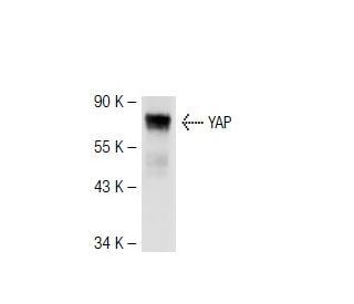 YAP Antibody (63.7) - Western Blotting - Image 44663 