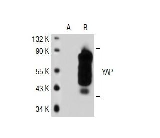 YAP (63.7): sc-101199. Western blot analysis of YAP expression in... 