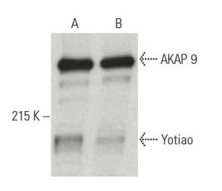 Yotiao Antibody (7) - Western Blotting - Image 396400