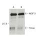 Yotiao Antibody (7) - Western Blotting - Image 396400