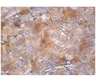 immunohistochemistry image from recommended YSK1 (E-5) monoclonal antibody replacement. Image 159988