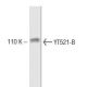 YT521-B Antibody (8) - Western Blotting - Image 133279