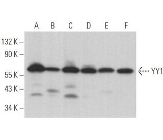 YY1 Antibody (H-10) - Western Blotting - Image 373915The Double Nickase Plasmid features a U6 promoter for sgRNA expression, a 20 nt targeting sequence, and a gRNA scaffold to guide Cas9n. It includes a CBh promoter for Cas9n (D10A) and puromycin resistance, GFP for transfection verification, and nuclear localization signals (NLS). The 2A peptide allows co-expression of Cas9n and Puro from a single promoter, enabling precise genome editing with reduced off-target effects.