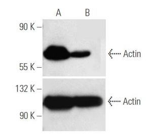 YY1 siRNA (h): sc-36863. Western blot analysis of YY1 expression in non-transfected control (A) and YY1 siRNA transfected 
