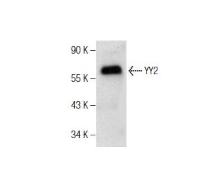 YY2 Antibody (A-5) - Western Blotting - Image 164553The Double Nickase Plasmid features a U6 promoter for sgRNA expression, a 20 nt targeting sequence, and a gRNA scaffold to guide Cas9n. It includes a CBh promoter for Cas9n (D10A) and puromycin resistance, GFP for transfection verification, and nuclear localization signals (NLS). The 2A peptide allows co-expression of Cas9n and Puro from a single promoter, enabling precise genome editing with reduced off-target effects.