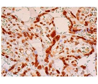 ZAC1 Antibody (C-7) - Immunohistochemistry - Image 310433 