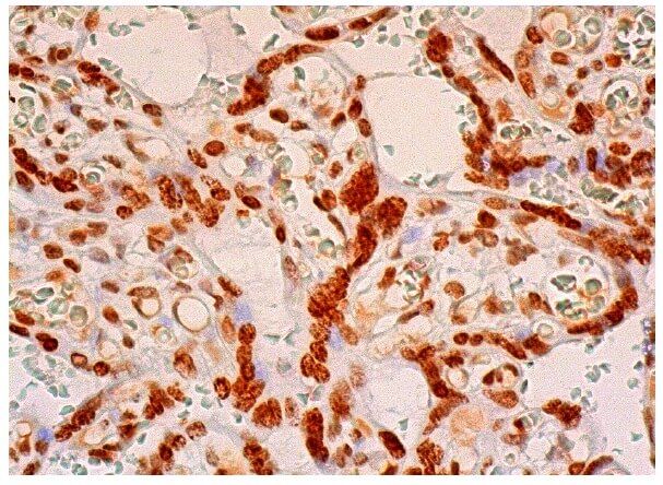 zac1-antibody-c-7-