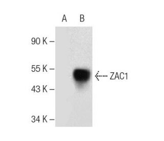 western blotting image from recommended ZAC1 (F-9) monoclonal antibody replacement. Image 281773
