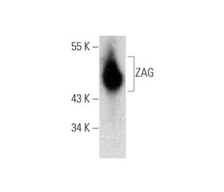 ZAG Antibody (H-3) - Western Blotting - Image 145531 