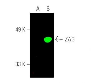ZAG Antibody (F-6) - Western Blotting - Image 389928Each CRISPR/Cas9 Knockout (KO) Plasmid product consists of a pool of 3 plasmids designed to ensure identification and cleavage of a specific gene for maximum knockout efficiency. Each plasmid encodes a unique 20 nt sequence derived from the GeCKO (v2) library.