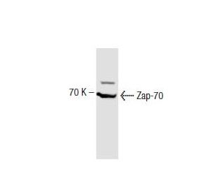 ZAP-70 Antibody (29) - Western Blotting - Image 138212
