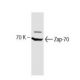 ZAP-70 Antibody (29) - Western Blotting - Image 138212