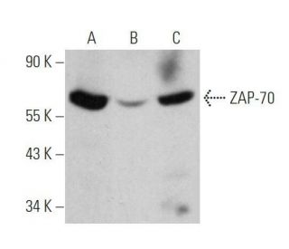ZAP-70 Antibody (3D2A4) - Western Blotting - Image 355292 