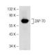 ZAP-70 Antibody (A-1) - Western Blotting - Image 141723