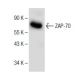ZAP-70 Antibody (A-8) - Western Blotting - Image 150037
