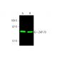 western blotting image from recommended ZAP-70 (1E7.2) monoclonal antibody replacement. Image 381581