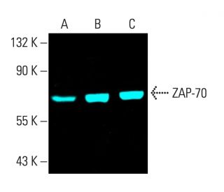ZAP-70 Antibody (1E7.2) - Western Blotting - Image 404229 