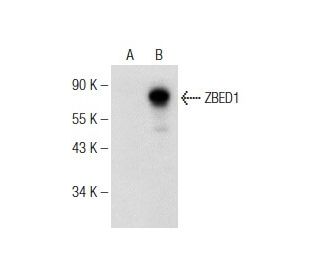 ZBED1 Antibody (G-6) - Western Blotting - Image 146450