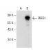 ZBED1 Antibody (G-6) - Western Blotting - Image 146450