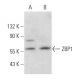 ZBP1 Antibody (H-9) - Western Blotting - Image 358017 
