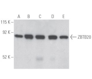 ZBTB20 Antibody (E-11) - Western Blotting - Image 398106