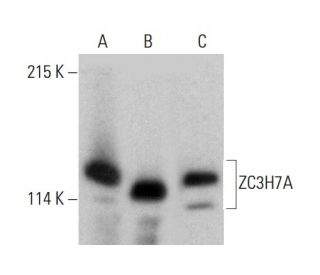 ZC3H7A Antibody (B-3) - Western Blotting - Image 387352 