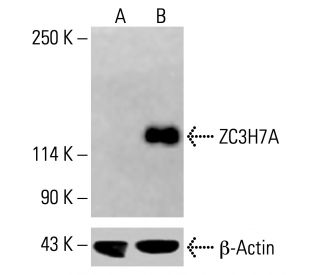 ZC3H7A Antibody (B-3) - Western Blotting - Image 415550