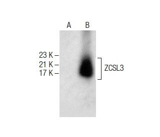 ZCSL3 Antibody (E-3) - Western Blotting - Image 287614 