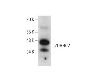 ZDHHC2 Antibody (C-2) - Western Blotting - Image 344477 