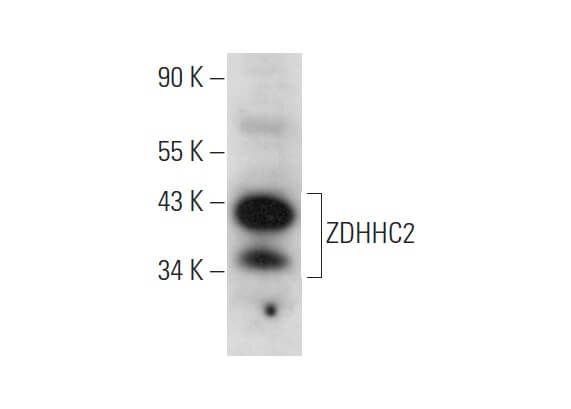 ZDHHC2 Antibody (C-2) | SCBT - Santa Cruz Biotechnology