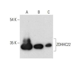 ZDHHC22 Antibody (C-5) - Western Blotting - Image 311734