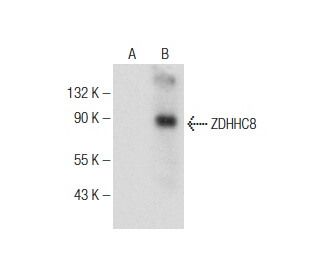 ZDHHC8 Antibody (B-3) - Western Blotting - Image 150871