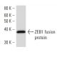 ZEB1 Antibody (416A7H10) - Western Blotting - Image 16840