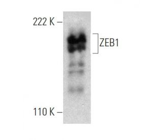 western blotting image from recommended ZEB1 (H-3) monoclonal antibody replacement. Image 364918