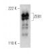 western blotting image from recommended ZEB1 (H-3) monoclonal antibody replacement. Image 364918