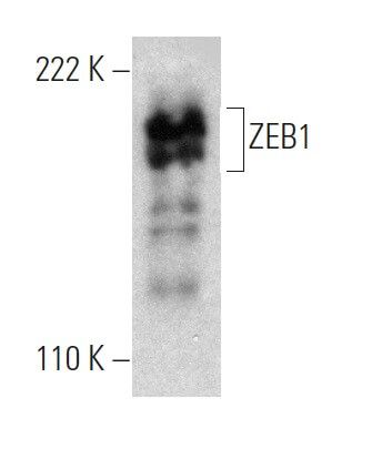 ZEB1 Antibody (H-3) | SCBT - Santa Cruz Biotechnology