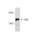 SIP1/ZEB2 Antibody (E-11) - Western Blotting - Image 138278