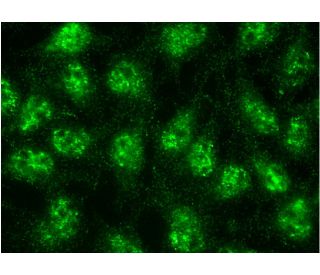 immunofluorescense image from recommended SIP1/ZEB2 (E-11)monoclonal antibody replacement. Image 145164