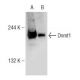 Zebularine: sc-203315. Western blot analysis of Dnmt1 expression in untreated (A) and Zebularine treated (B) HeLa whole ce 