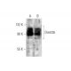 Zebularine: sc-203315. Western blot analysis of Dnmt3b expression in untreated (A) and Zebularine treated (B) HeLa whole c
