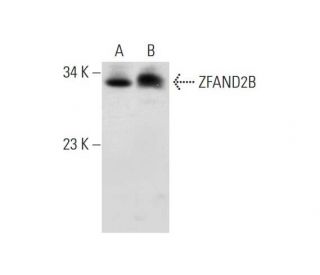 ZFAND2B Antibody (C-5) - Western Blotting - Image 326479 