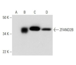 ZFAND2B Antibody (F-2) - Western Blotting - Image 300484