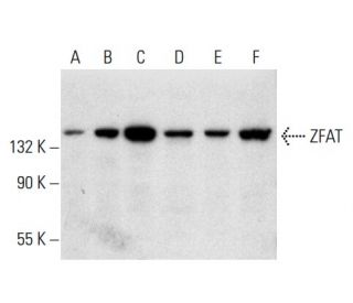 ZFAT Antibody (E-9) - Western Blotting - Image 300567 