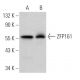 ZFP161 Antibody (C-4) - Western Blotting - Image 366249 
