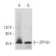 ZFP161 Antibody (C-4) - Western Blotting - Image 366253