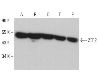 ZFP2 Antibody (E-9) - Western Blotting - Image 368385 