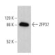ZFP37 Antibody (15) - Western Blotting - Image 379400 