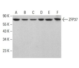 ZFP37 Antibody (15) - Western Blotting - Image 381259Each CRISPR/Cas9 Knockout (KO) Plasmid product consists of a pool of 3 plasmids designed to ensure identification and cleavage of a specific gene for maximum knockout efficiency. Each plasmid encodes a unique 20 nt sequence derived from the GeCKO (v2) library.