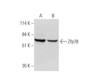 Zfp78 Antibody (B-12) - Western Blotting - Image 344516